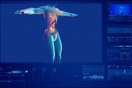 Kidney Transplant Surgery in India