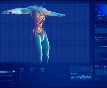 Kidney Transplant Surgery in India