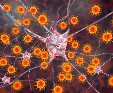 Nipah Virus 2
