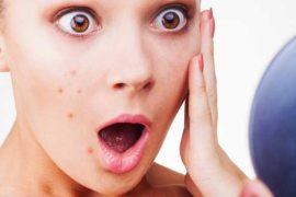Deal With Acne