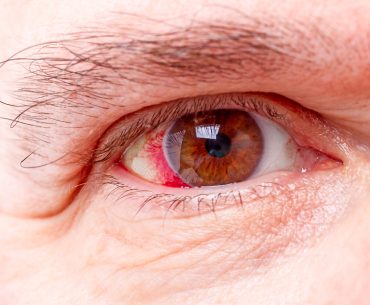 Retina