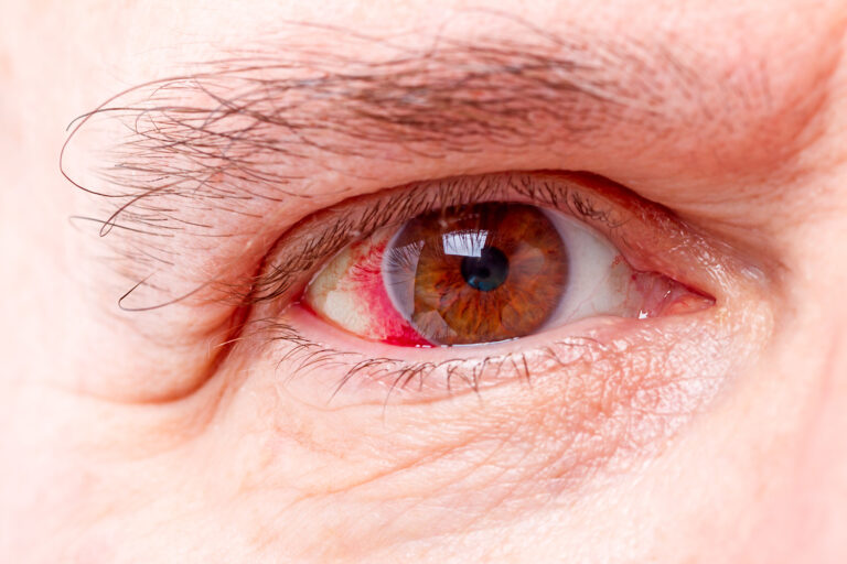 Top warning signs of a damaged Retina